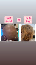 Load image into Gallery viewer, Hair Growth Starter Kit: Essential Products for Thicker, Healthier Hair
