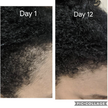 Load image into Gallery viewer, Before and after Miracle Rice Oil treatment, showcasing hair regrowth and healthier strands
