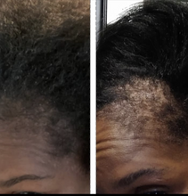 Load image into Gallery viewer, Before and after hair growth results using Miracle Rice Oil, showing thicker hair growth&quot;
